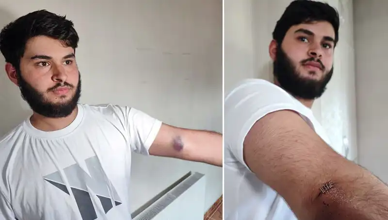 Bahçeye Kaçan Top Mahalleyi Karıştırdı: İnanılmaz Olayın Ayrıntıları!